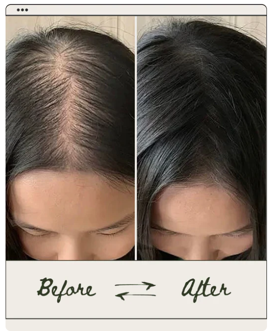 🌿Shampoing Bio à Base de Romarin Croissance Capillaire